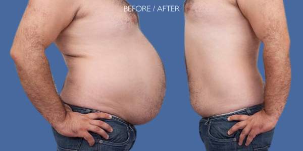 xr:d:DAFoVUYAltk:185,j:8525710488177310585,t:23071312