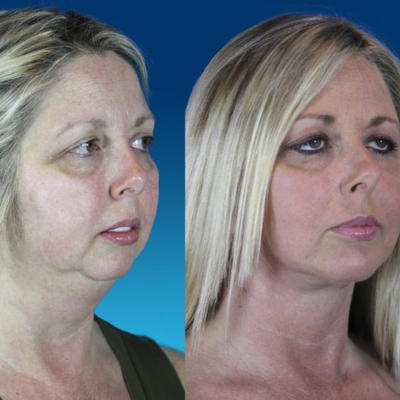 Untitled design - 2026-02-03T155212.264