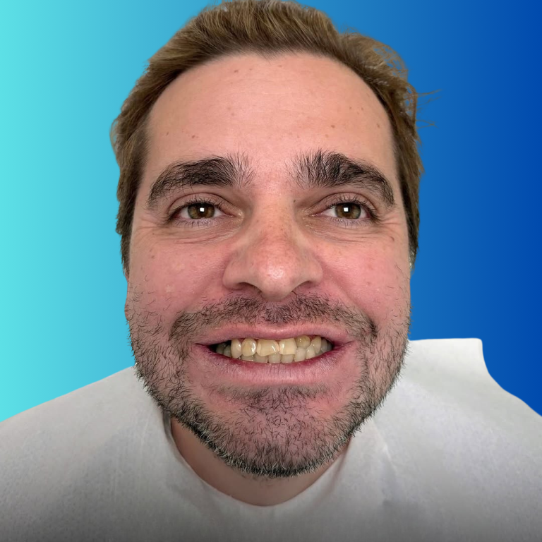 hollywood smile (15)