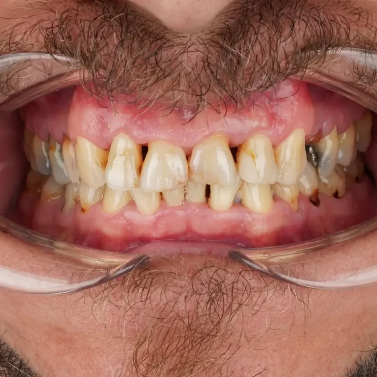 hollywood smile (21)