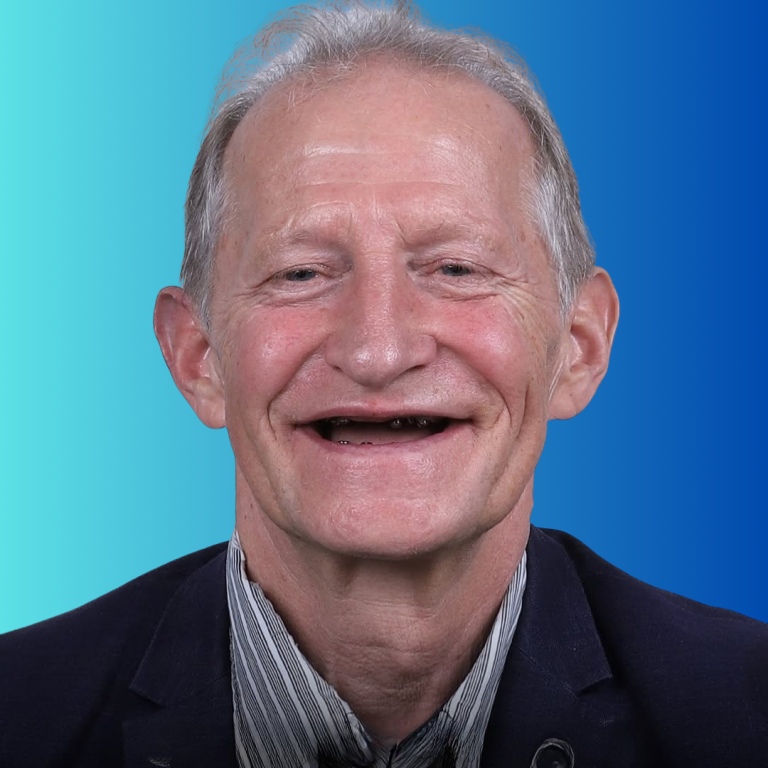 hollywood smile (33)